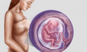 Zašto vam je muka prije porođaja, uzroci mučnine kod trudnica, šta učiniti?