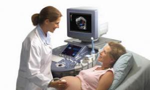 Scheduled ultrasounds First planned ultrasound of pregnancy